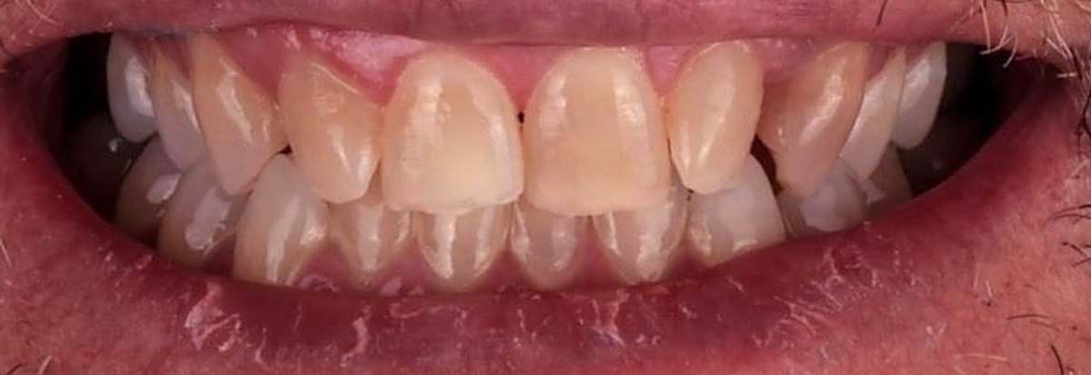 Real Love Dental patient smile before treatment