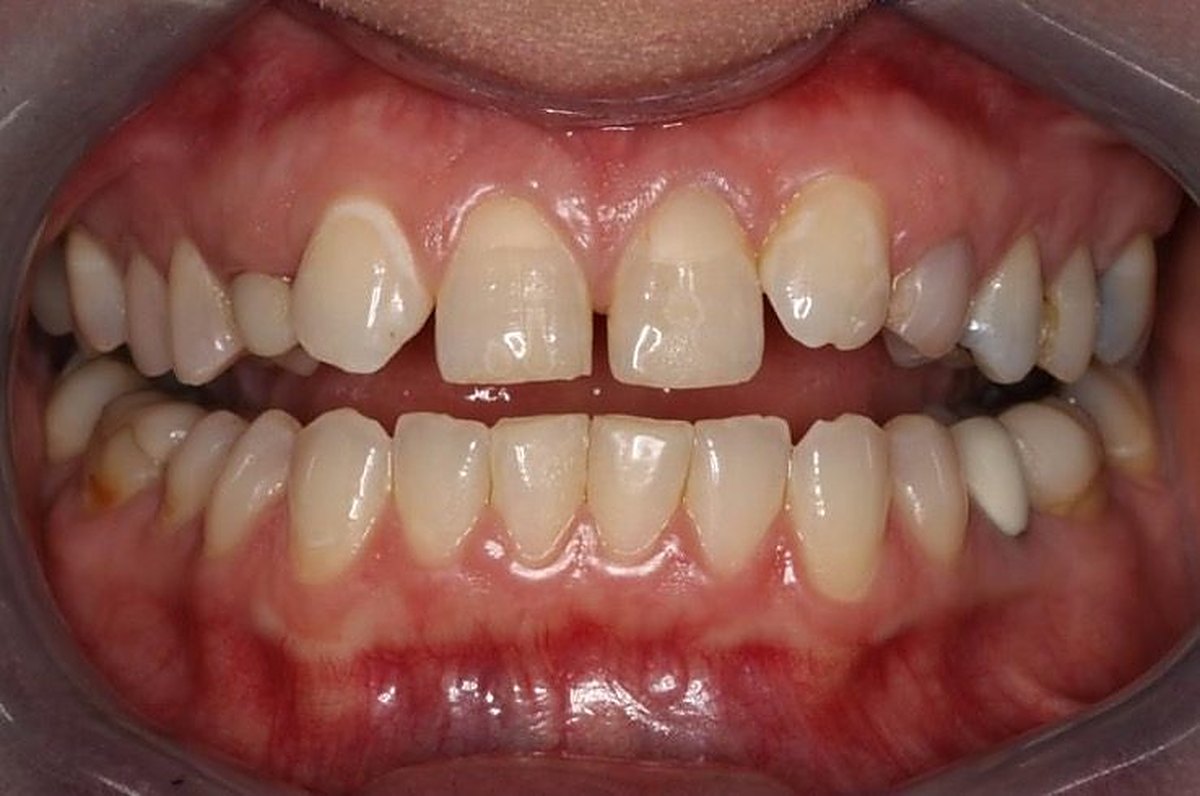 Real Love Dental patient smile before treatment