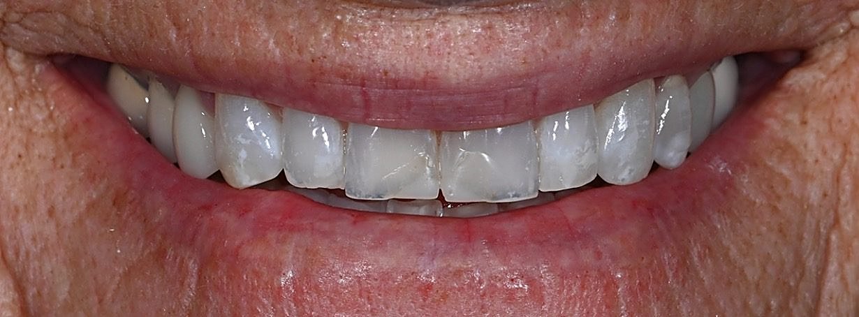 Real Love Dental patient smile before treatment
