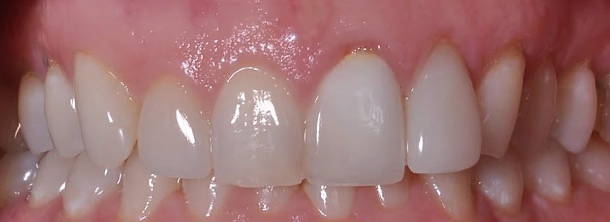 Real Love Dental patient smile before treatment