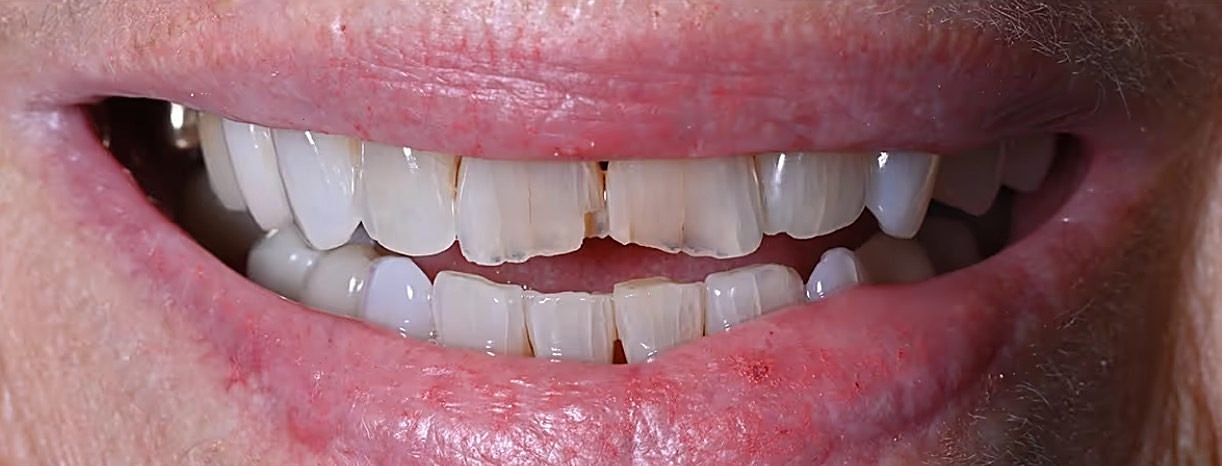Real Love Dental patient smile before treatment